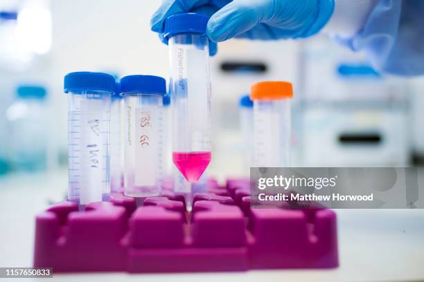 Scientist places a medical sample into a test tube holder in a medical laboratory on June 15, 2019 in Cardiff, United Kingdom.