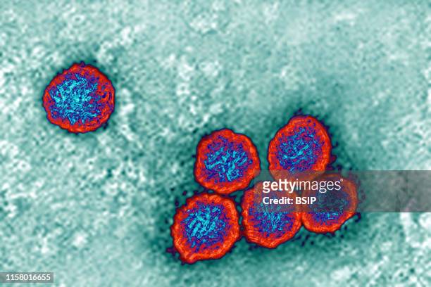 Flavivirus , these viruses are responsible for yellow fever, dengue fever, Japanese encephalitis, Zika virus and West Nile encephalitis. They are...