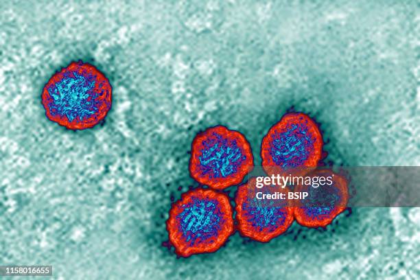 470 Yellow Fever Virus Stock Photos, High-Res Pictures, and Images