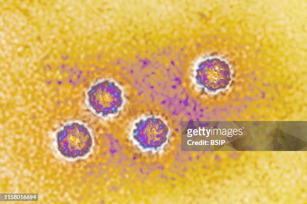 Hepatitis A virus . HAV causes a hepatitis that is almost always benign. Image made from transmission electron microscopy. Approximate viral...