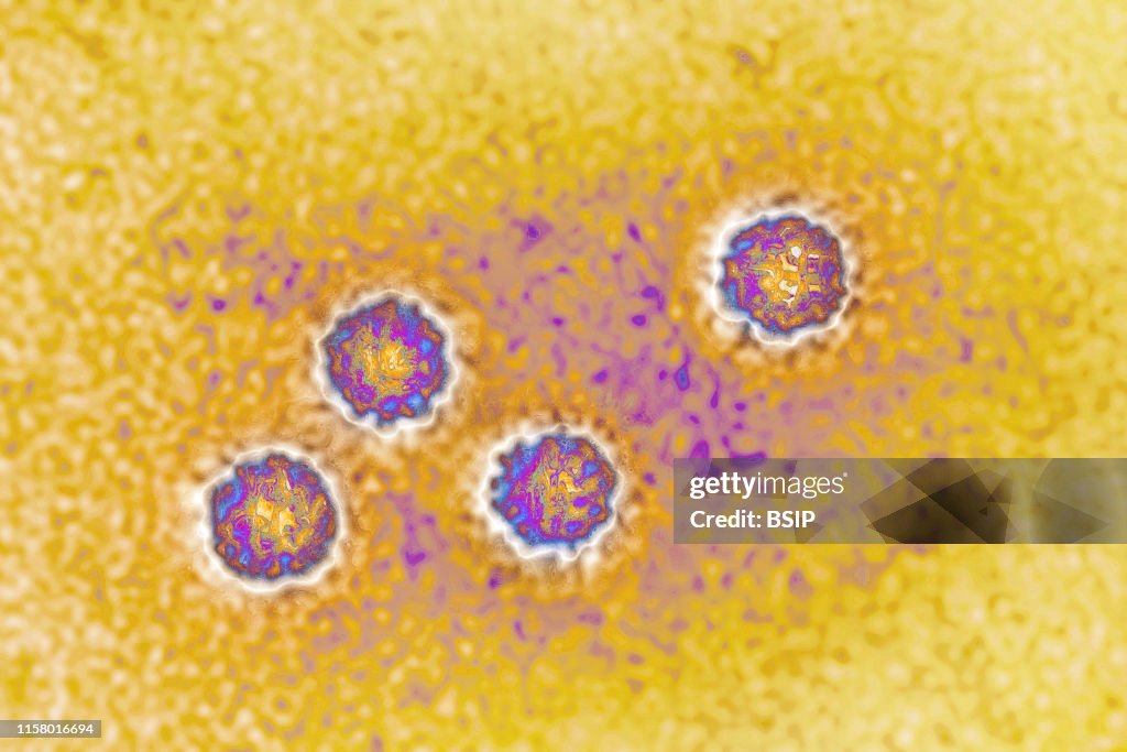 Hepatitis A virus