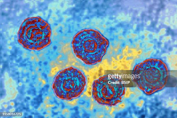 Hepatitis C virus . HCV causes blood-borne hepatitis, cirrhosis occurs in 25% of cases, 10 to 20 years after the onset of infection, with a risk of...