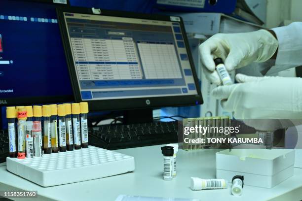 Lab-technician analyses biological samples at Lancet laboratories, the only World Anti Doping Agency accredited facility for eastern Africa, in the...