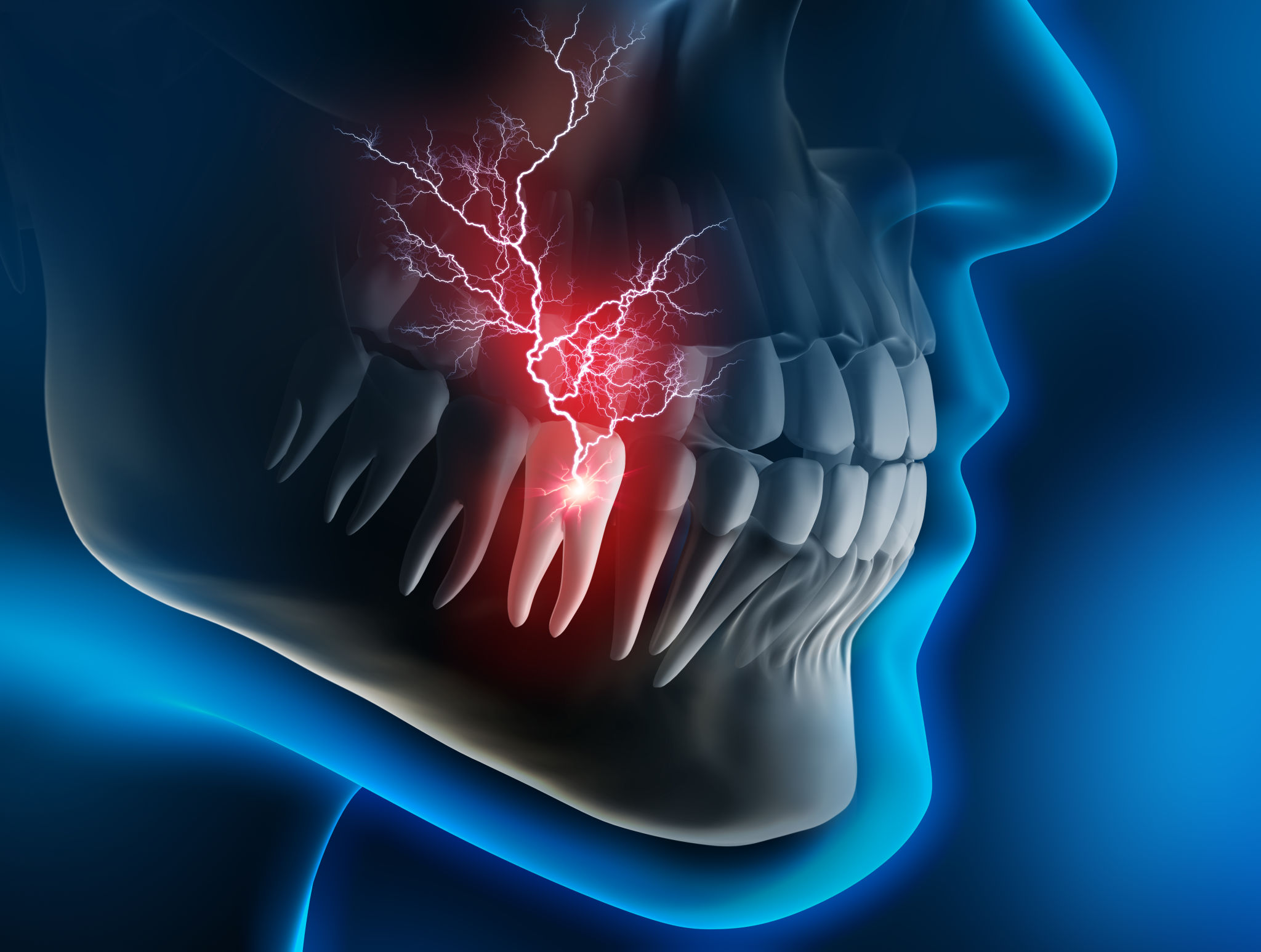 Medical Visualization - Toothache Medical Visualization - Toothache