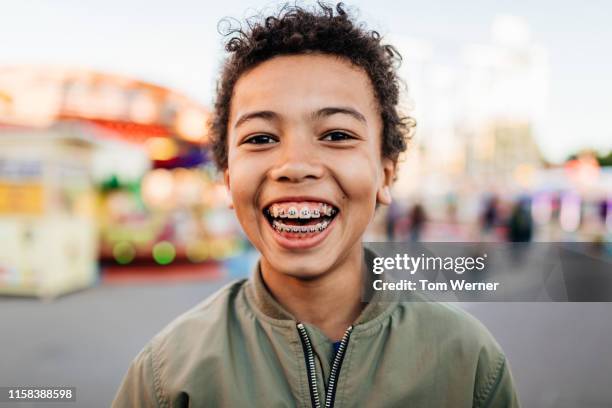 young boy with braces and wide smile - braces fotografías e imágenes de stock