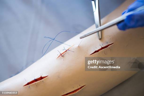 mano di studi medico femminile suturando una ferita - mani fili foto e immagini stock