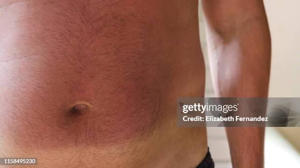 midsection of men with sunburn - marque de bronzage photos et images de collection