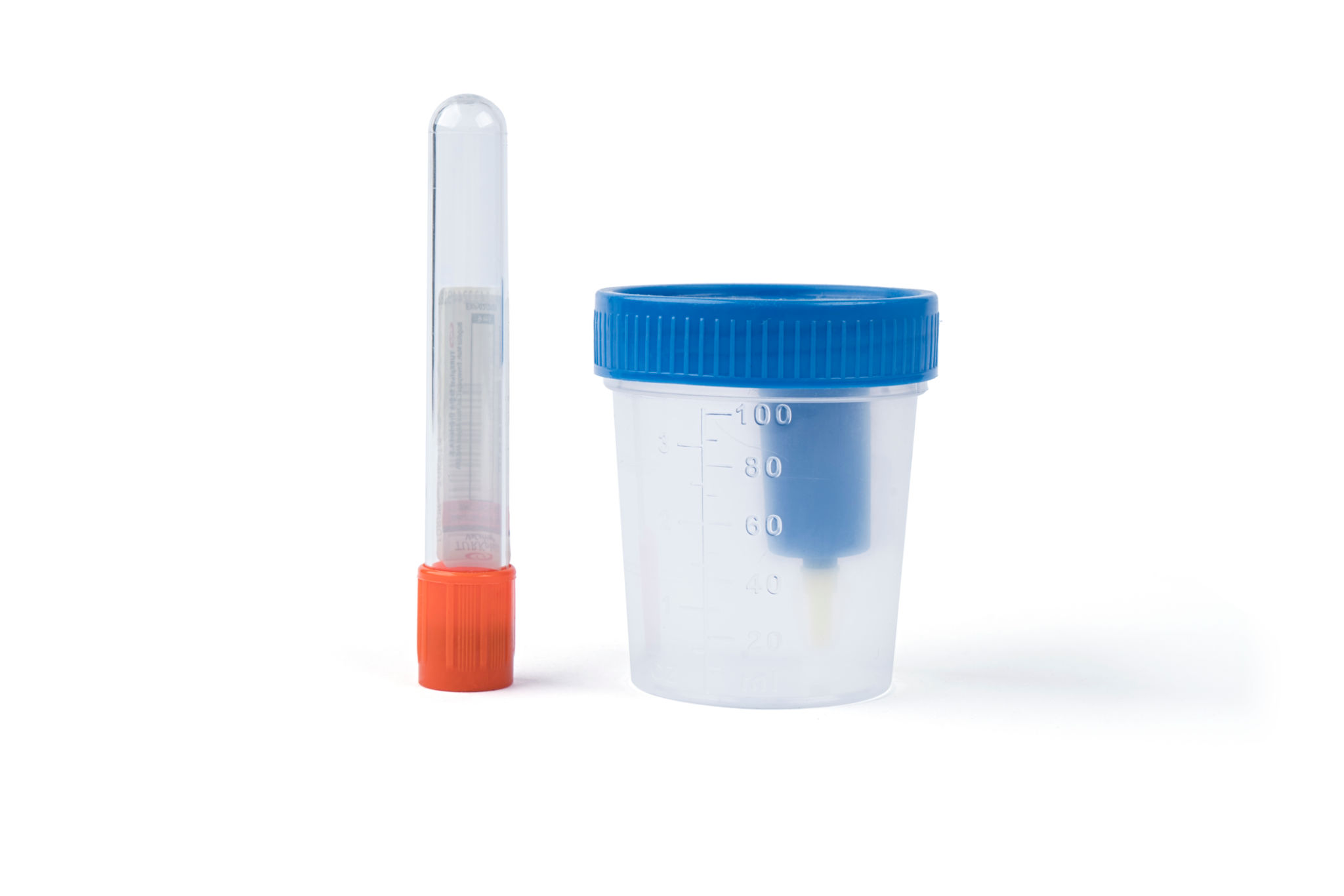 urine sample collection