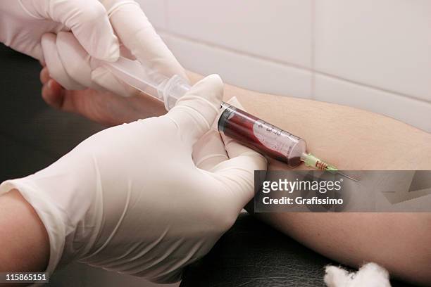 blood extraction with syringe at hospital - syringe full of blood stockfoto's en -beelden