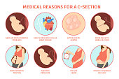 Medical reasons for cesarean delivery