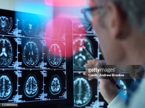 doctor viewing brain scans for possible disease or damage in clinic - scan stock-fotos und bilder