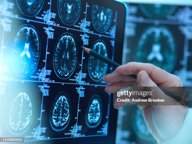 doctor viewing brain scans for possible disease or damage in clinic - nervous system foto e immagini stock