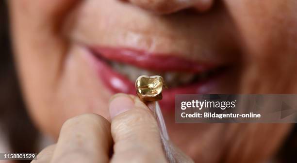 Dental gold, gold tooth, Zahngold, Goldzahn.