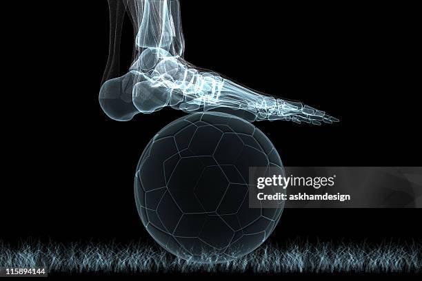 xray - soccer injury stock-fotos und bilder