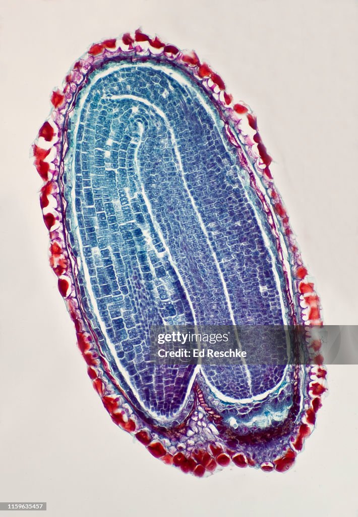 PLANT EMBRYO with COTYLEDONS (or Seed Leaves), RADICLE and HYPOCOTYL (Cepsella bursa-pastoris, Shepherd's Purse), 25X