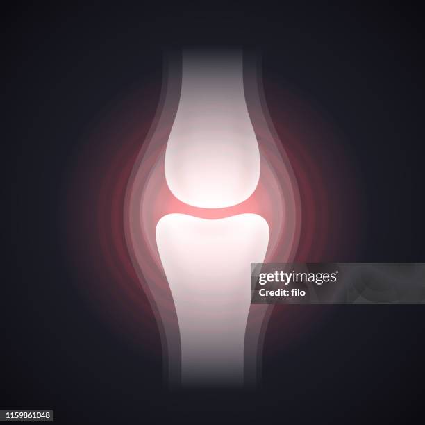 illustrazioni stock, clip art, cartoni animati e icone di tendenza di dolori articolari al ginocchio o lesioni radiografie - knee replacement surgery