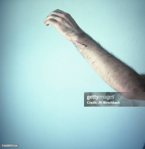 man's arm with bloody scratch - hairy man stockfoto's en -beelden