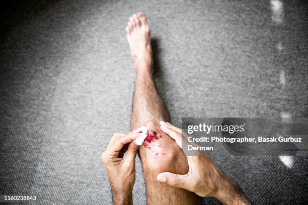 man medical dressing his own bruised / injured /wounded knee - down on one knee fotografías e imágenes de stock