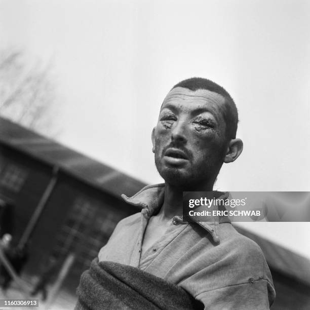 Graphic content / A tortured prisoner is seen in the Buchenwald concentration camp in April 1945. - Created in July 1937 near Weimar, Germany, the...