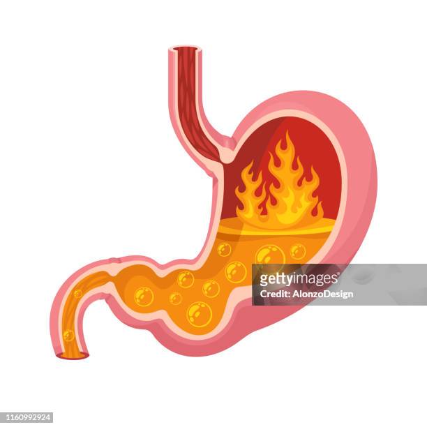 stockillustraties, clipart, cartoons en iconen met maagzuur branden vector - human digestive system