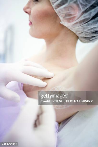 botox injection in underarm - armpit stock-fotos und bilder