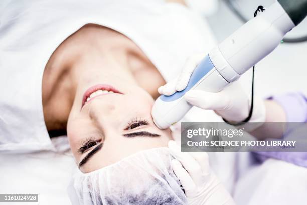 laser peeling treatment - beauty laser bildbanksfoton och bilder