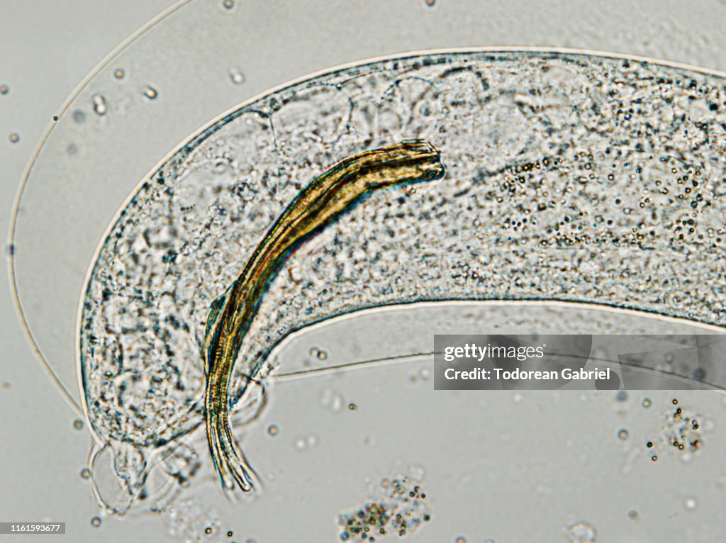 The tail of Aelurostrongylus abstrusus, cat lungworm under the microscope