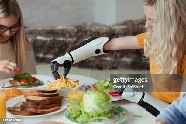 wat frietjes - artificial limb stockfoto's en -beelden