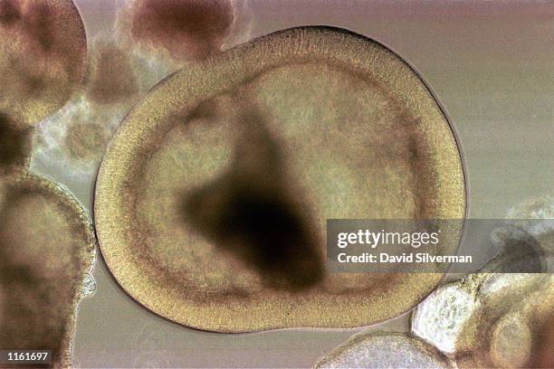 An embryoidic body, a stem cell which has differentiated in suspension and which has the ability to become any kind of human cell, grows in a...