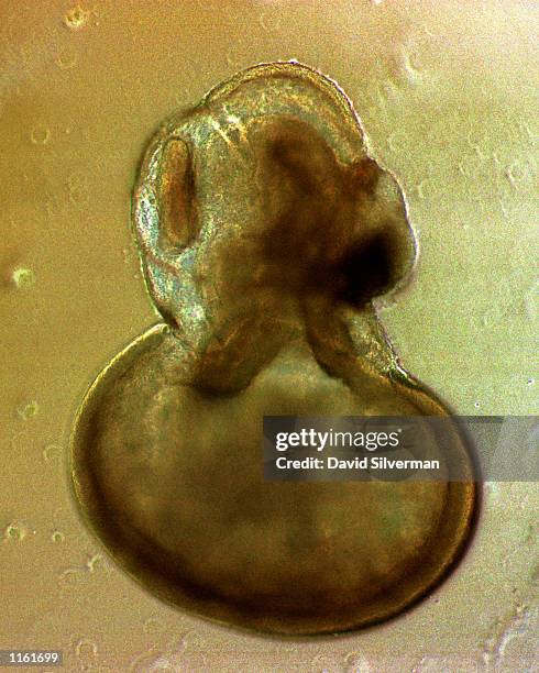 An embryoidic body, a stem cell which has differentiated in suspension and which has the ability to become any kind of human cell, grows in a...