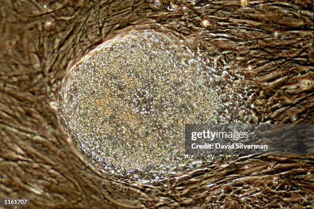 Human stem cell colony, which is no more than 1mm wide and comprises thousands of individual stem cells, grows on mouse embryonic fibroblast in a...