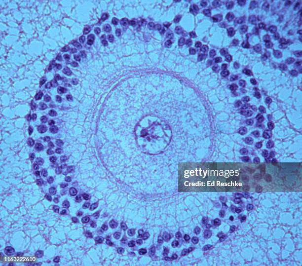 oocyte inside an ovarian follicle--zona pellucida, corona radiata, nucleus, 100x - human egg stock pictures, royalty-free photos & images