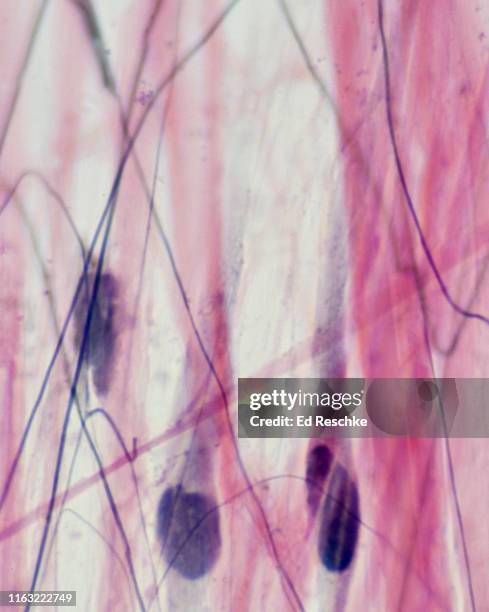 loose or areolar connective tissue--fibroblasts, elastic fibers, collagenous fibers 400x - fibroblasto imagens e fotografias de stock