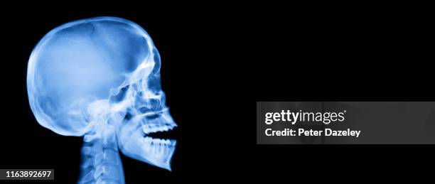 x-ray of human skull, side on - skull xray no brain stock pictures, royalty-free photos & images