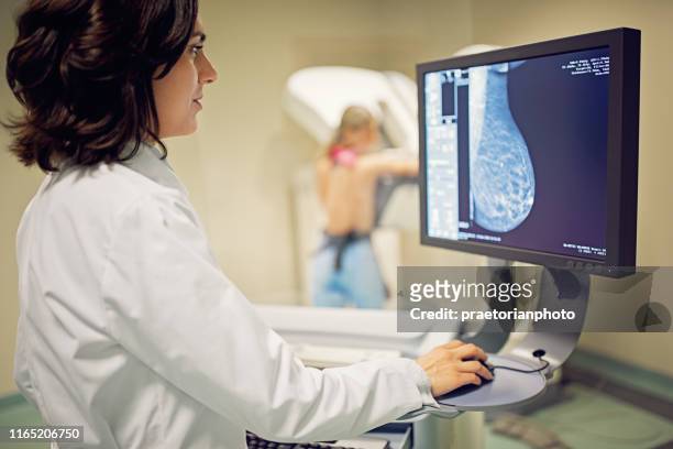 il medico sta lavorando con lo scanner a raggi x mammografico in ospedale - seno foto e immagini stock