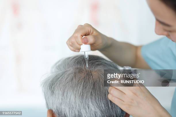 doctor giving treatment serum on scalp - hair loss stock pictures, royalty-free photos & images