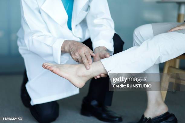 oriental medicine doctor checking patient's ankle pain - distenção imagens e fotografias de stock