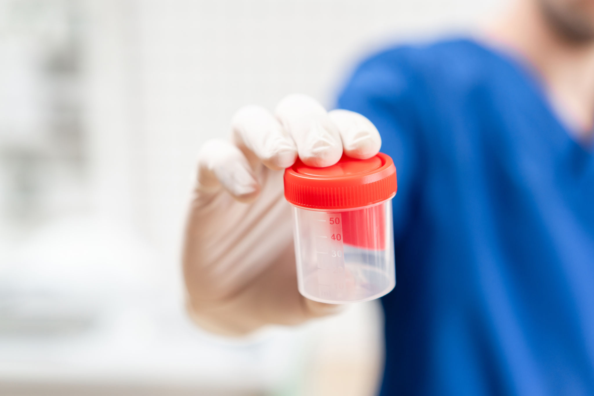 drug test samples