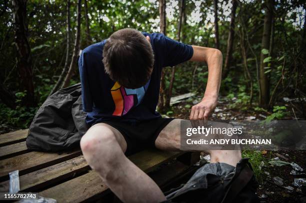 Graphic content / TOPSHOT - Drug addict Michael injects cocaine into a vein in his leg in a small wooded area used by addicts to take drugs near...
