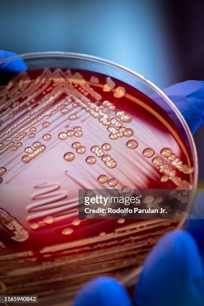 mrsa on blood agar plate - antibiotic resistant fotografías e imágenes de stock
