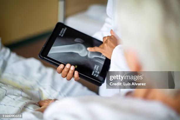 doctor showing result of radiography to patient - patient healthcare technology stock-fotos und bilder