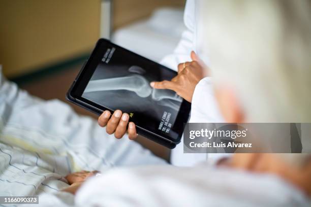 doctor showing result of radiography to patient - röntgen stockfoto's en -beelden