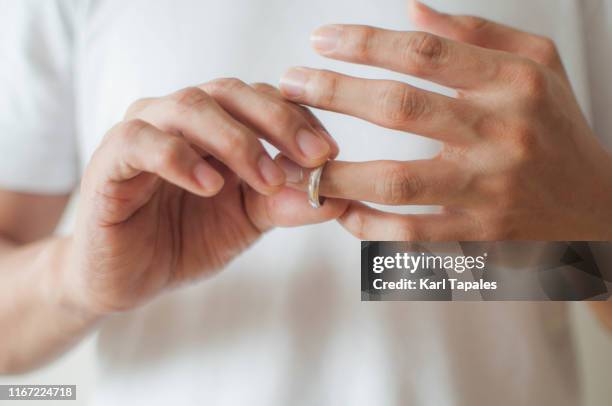 a young man is removing his wedding ring a concept of relationship difficulties - divorzio foto e immagini stock