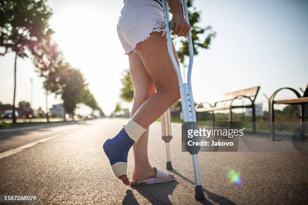 mujer joven con la pierna rota disfrutando en un día soleado de verano - pierna fracturada fotografías e imágenes de stock