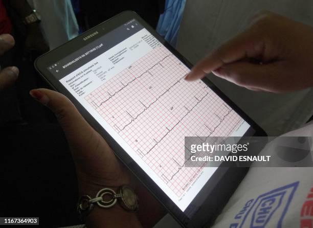 An Ivorian doctor uses a tablet computer in Bouake hospital's trailblazer telemedicine departement for heart diseases, in Bouake on June 20, 2019. -...