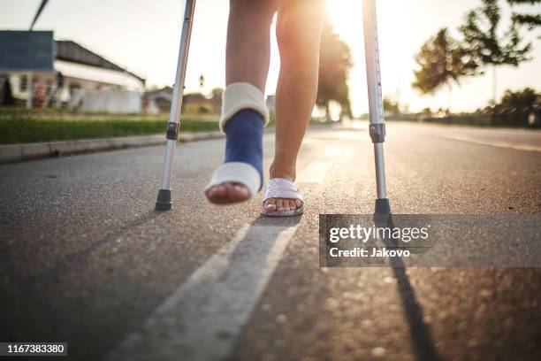 junge frau mit gebrochenem bein genießen in einem sonnigen sommertag - orthopedic cast stock-fotos und bilder