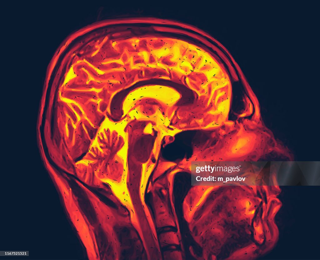 Mri Function Magnetic Resonance Imaging Of The Brain Mri Scan Vector High-Res Vector ...