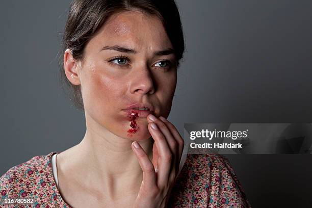 a woman with bruises and bloody lip - painful lips stock pictures, royalty-free photos & images