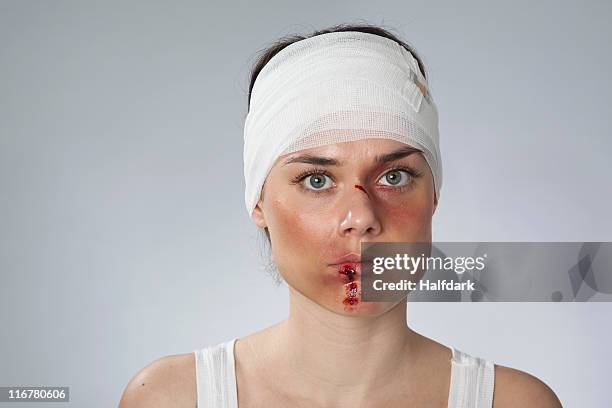 a woman with injuries and a bandaged head - gauze stock-fotos und bilder