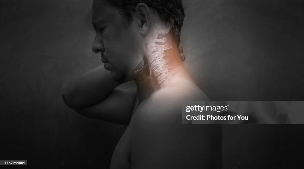 Men who have neck pain due to cervical spondylosis He must hurry to see a doctor for treatment.